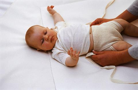 После родов вывих тазобедренного сустава