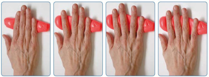 Как лучше разработать палец после перелома