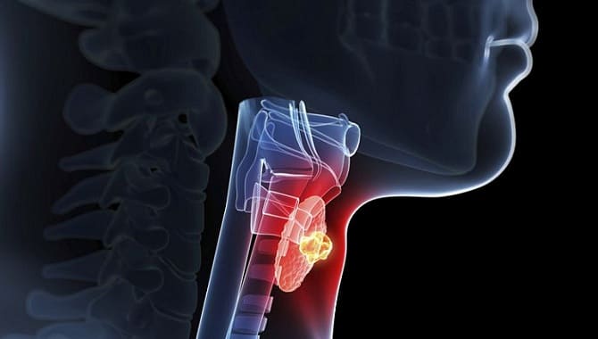 Патология щитовидной железы