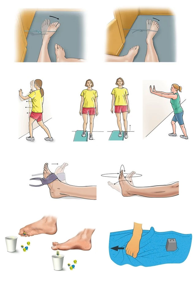 Как восстановить ногу после перелома стопы