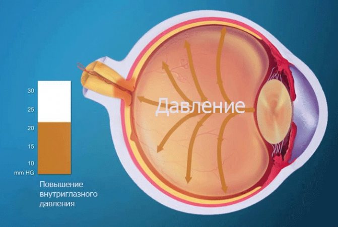 Доклад по теме Сосудистые факторы риска развития глаукомы с нормальным давлением