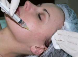 Как вылечить воспаление сальной железы на лице
