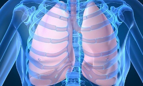 Пневмония киста на легком лечение thumbnail