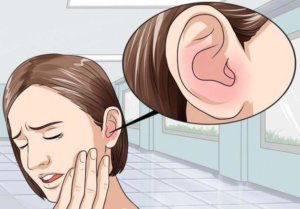 Чаще всего прострелы в ушах являются признаками евстахиита!