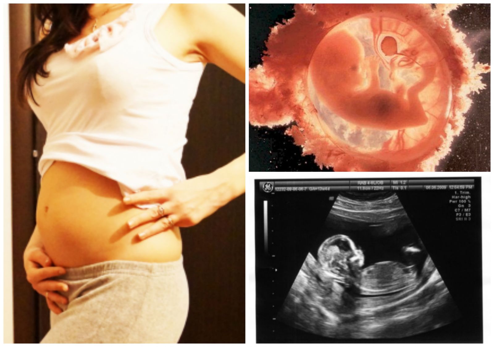 13 акушерская неделя. Ребенок на 13 неделе беременности УЗИ. Размер эмбриона в 13 недель беременности. 13 Недель беременности фото плода на УЗИ.