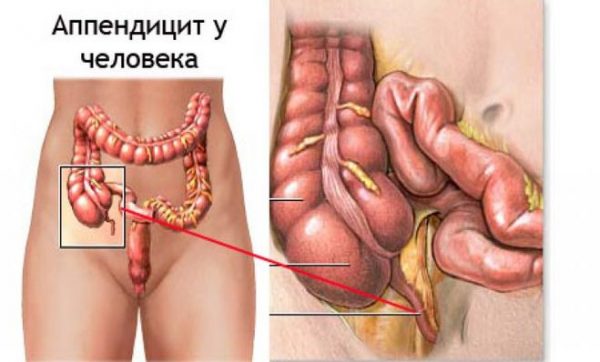 Боли слева в пояснице и внизу живота при беременности