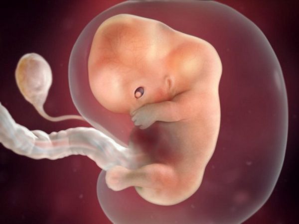 Колит живот на раннем сроке беременности форум thumbnail