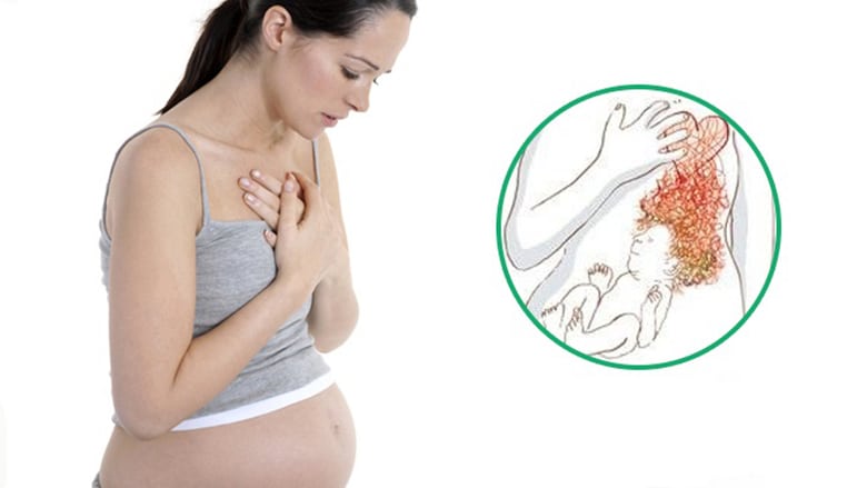 Кружится голова у беременной. Остеохондроз шейного отдела при беременности. Шейный остеохондроз у беременных. Остеохондроз при беременности симптомы. Хондроз и беременность.